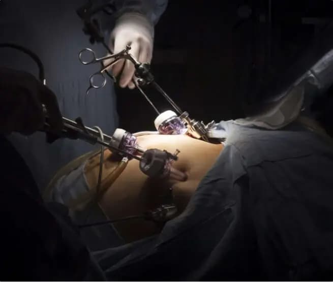 general Surgery