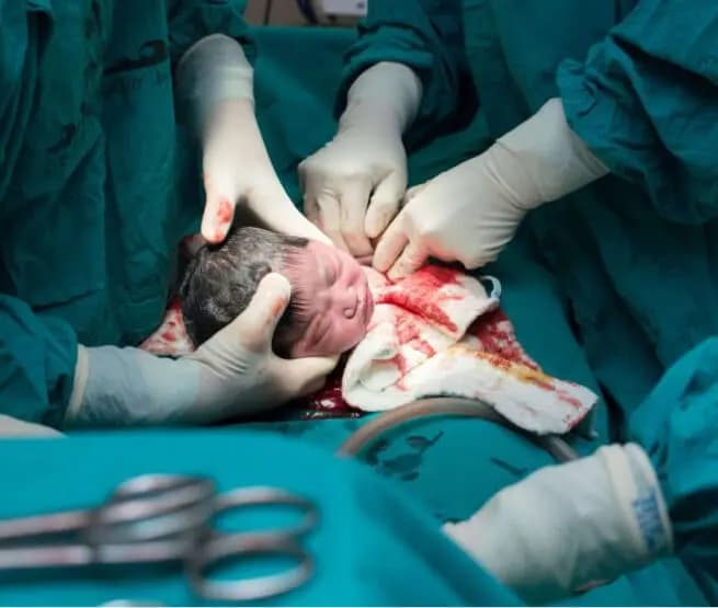 ob/gyn Surgery